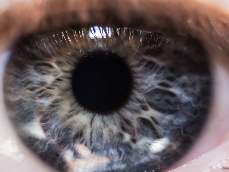 Exame de Acuidade a Laser em Curitiba